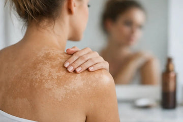 Why Does Fake Tan Fade Blotchy? - R.B.F Cosmetics